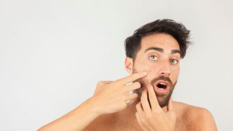 طريقة للقضاء على حبوب الوجه