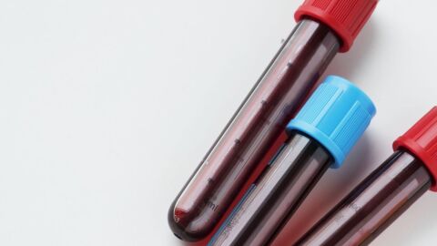 تحليل فصيلة الدم