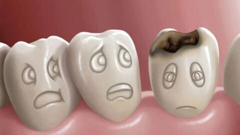 أسباب سقوط الأسنان