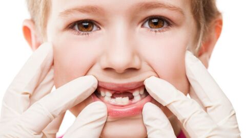 فقدان الأسنان عند الأطفال ودور الأهل - فيديو