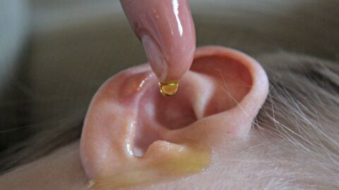 علاج فطريات الأذن