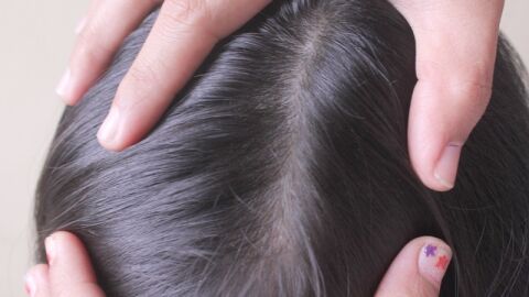 كيف أعرف بوجود القمل في الشعر