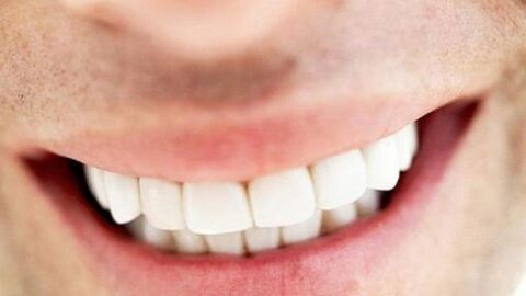 كيف نحافظ على سلامة الأسنان
