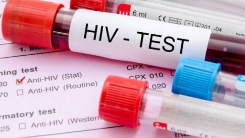 كيف يمكن اكتشاف مرض الإيدز