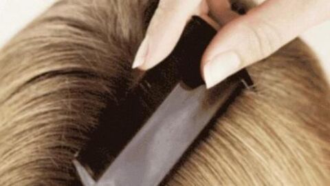 كيفية التخلص من قمل الشعر