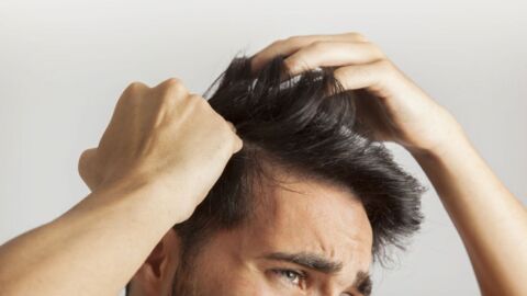 كيفية التخلص من قشرة الشعر للرجال