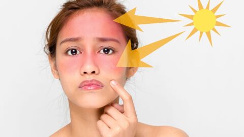 كيفية التخلص من آثار الشمس على الوجه