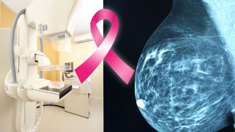 كيفية معرفة الإصابة بسرطان الثدي