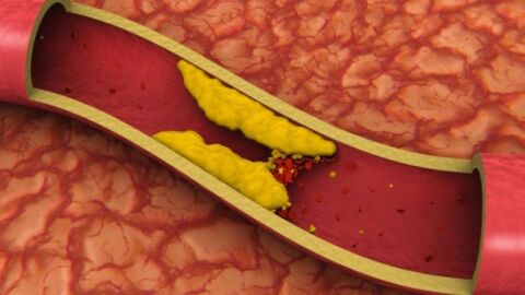 كيفية تخفيض الكولسترول في الدم