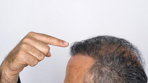 كيفية حماية الشعر من التساقط للرجال
