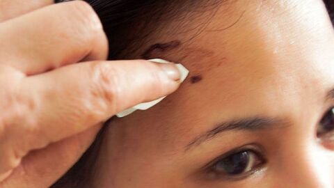 كيفية إزالة صبغة الشعر من الجلد