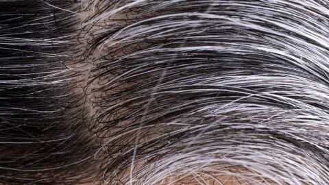 كيفية علاج شيب الشعر
