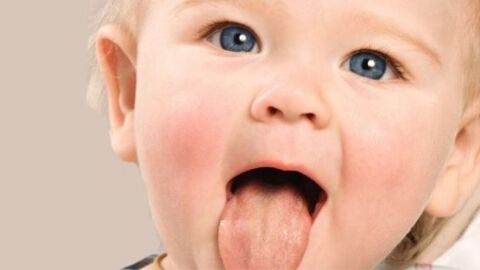 كيفية علاج فطريات الفم عند الأطفال