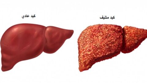 معلومات عن فيروس سي