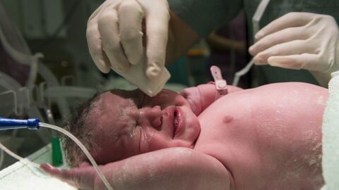 الولادة الطبيعية والولادة القيصرية والفرق بينهما