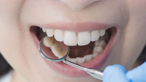 أعراض سرطان الفم والأسنان