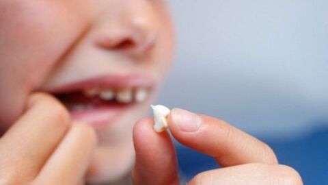 فقدان الأسنان الدائمة عند الأطفال - فيديو