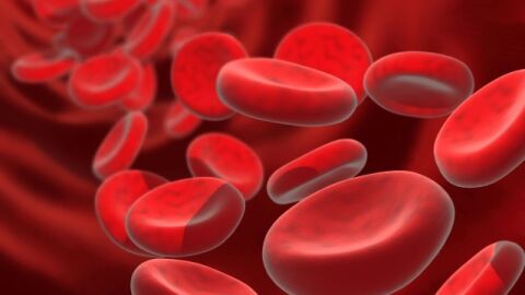 وصفات لعلاج فقر الدم الحاد
