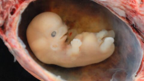 حكم إجهاض الجنين في الشهر الثاني