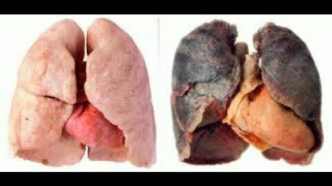 أضرار التدخين على صحة الجسم