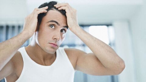 حل مشكلة تساقط الشعر عند الرجال
