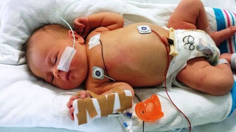 أعراض الثقب في القلب عند الرضع