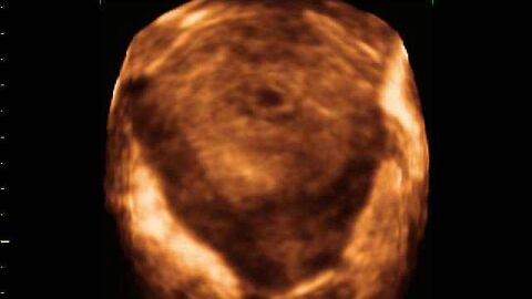 شكل الجنين في الشهر الثاني من الحمل