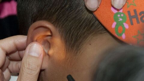 طرق علاج طنين الأذن