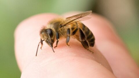 علاج حساسية لسع النحل