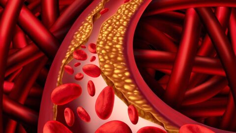 طرق تقليل نسبة الكولسترول في الدم