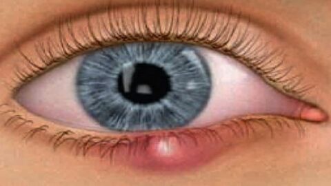 ما هي أسباب حساسية العين