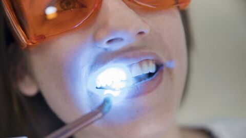 ما هي أضرار تبييض الأسنان