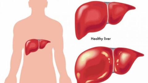 ما هي أمراض الكبد وأعراضها