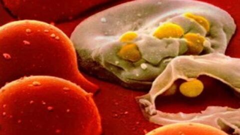 ما هي الأمراض التي تعالج بالخلايا الجذعية