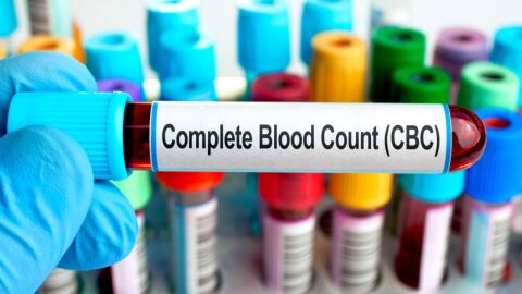 ما هو تحليل الدم cbc