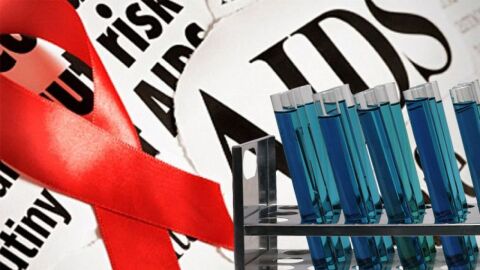 ما هو أصل مرض الأيدز