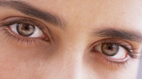 ما سبب ظهور الهالات السوداء تحت العينين