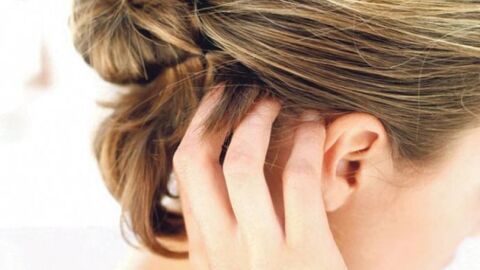 ما هو علاج حكة فروة الرأس
