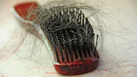 ما علاج تساقط الشعر عند النساء