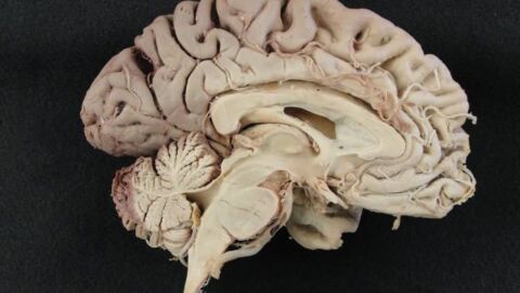 أين يقع المخ في رأس الإنسان