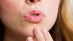 أسباب جفاف الشفاه