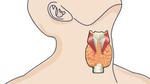 أسباب قصور الغدة الدرقية