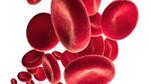 تشخيص مرض فقر الدم