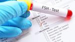 تحليل fsh للنساء