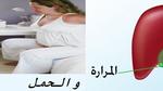 حصوة المرارة والحمل