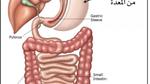 أضرار عملية تحويل مسار المعدة