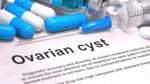 كيفية التخلص من التكيس على المبايض
