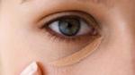 كيف أزيل سواد تحت العينين