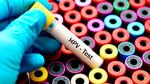 تحليل hpv للرجال