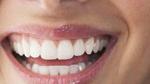 أسرع وأسهل طريقة لتبييض الأسنان